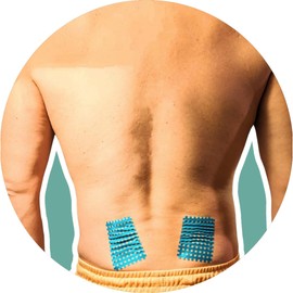 AcuTop XXL Grid Tape, Pack of 20, Acupuncture Plasters (Blue)