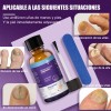 Fungicida Para Uñas Para Uñas Dañadas,rotas Y Decoloradas