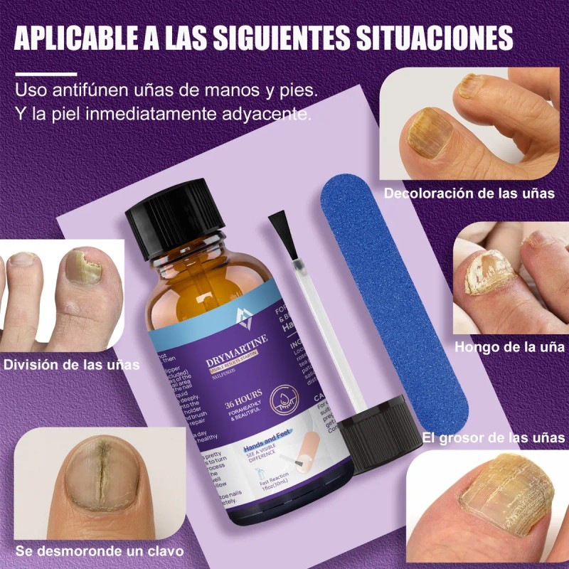 Fungicida Para Uñas Para Uñas Dañadas,rotas Y Decoloradas