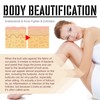 KOAHDE The Butt And Thigh Area,Butt Pimple Removing Cream,Reduce Acne