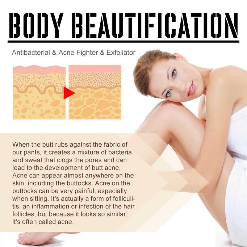 KOAHDE The Butt And Thigh Area,Butt Pimple Removing Cream,Reduce Acne