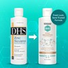 DHS Zinc Shampoo – Dandruff Shampoo – for Flaky and