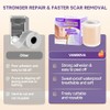 Reusable Silicone Scar Tape for Effective Scar Treatment