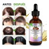 Aliver - Aceite Capilar Natural 11 Aceites Fortalecedor Kit 2pz
