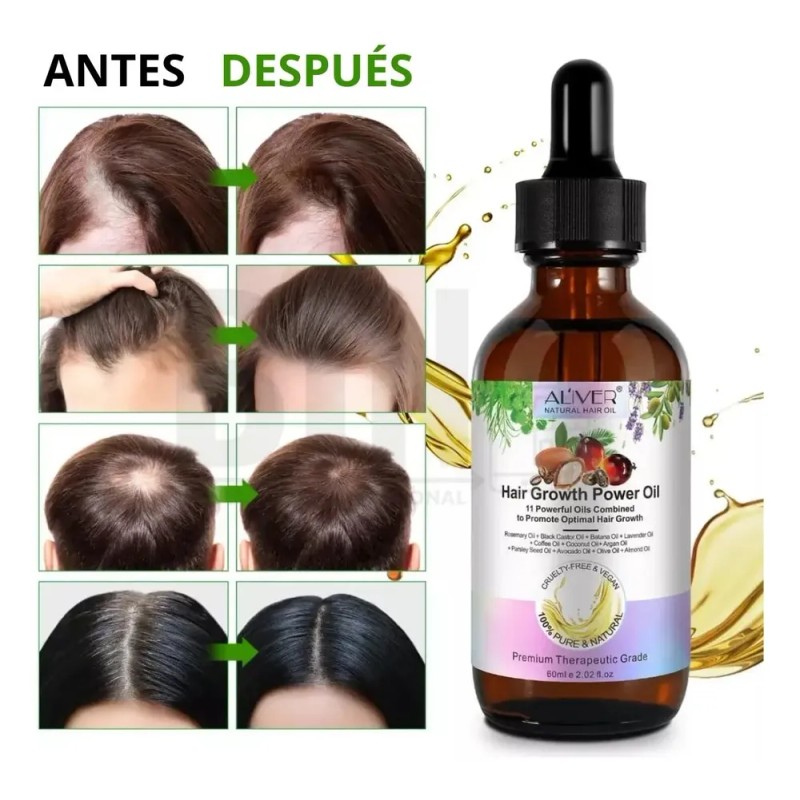 Aliver - Aceite Capilar Natural 11 Aceites Fortalecedor Kit 2pz