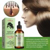 Aceite Esencial Eelhoe Rosemary Hair Care, Reparador Para Ca