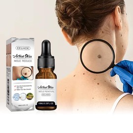 Active Skin Mole Reduce Serum 10ml – Gentle Face & Neck Treatment, Non-Greasy, Hydrating, Anti-Aging, Vitamin C Boost, Sensitive Skin Friendly