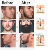 Beard Growth Kit,Beard Oil Beard Growth Serum for Men,0.5MM Derma