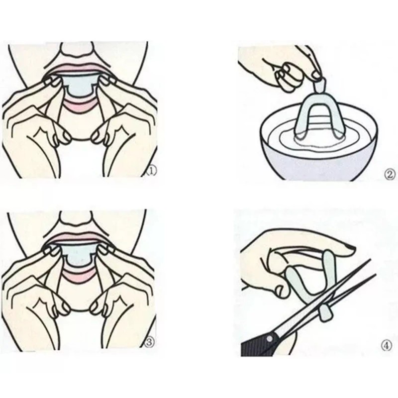 Veraly Protectores Bucales, Guardas Dentales De Gel Moldeables 2pz Color