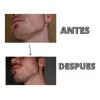 Kit Para Crecimiento Y Estimulación De Barba Barbers