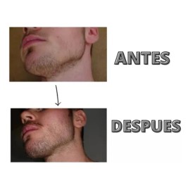 Kit Para Crecimiento Y Estimulación De Barba Barbers