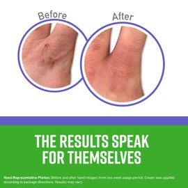 O'Keeffe's Working Hands Night Treatment Hand Cream, 7 Ounce Tube, (Pack of 2)