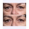Wrinkles Schminkles Eye Smoothing Kit