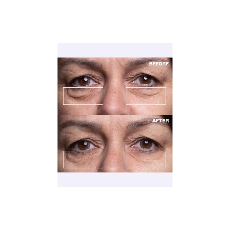 Wrinkles Schminkles Eye Smoothing Kit