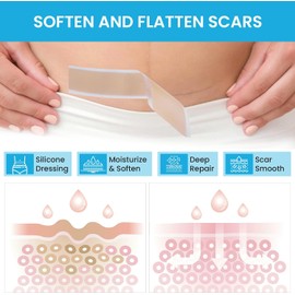 Láminas de silicona para cicatrices, rollo de cinta adhesiva de silicona suave para cicatrices, tiras de silicona reutilizables para cicatrices quirúrgicas, queloides, cicatrices de acné, cicat