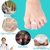 Byehambuni Hammer Toe Straightener, 6 Pack Hammer Toe Corrector for