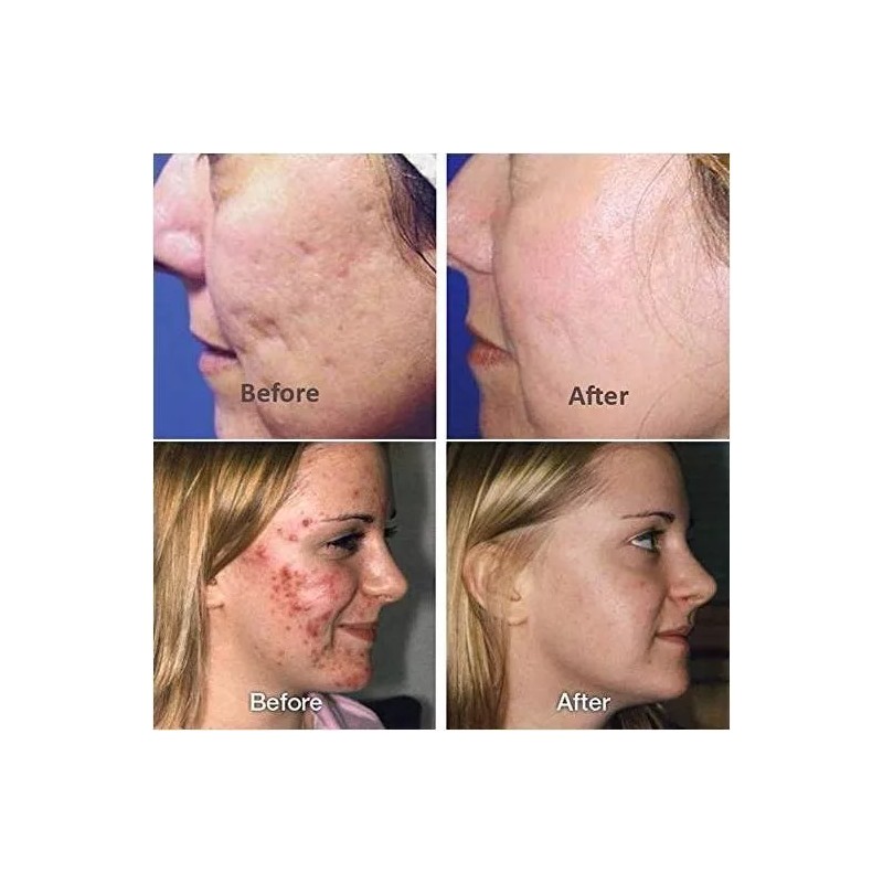 Universo en Linea Images Esencia Acido Hialurónico Reparadora Piel Full