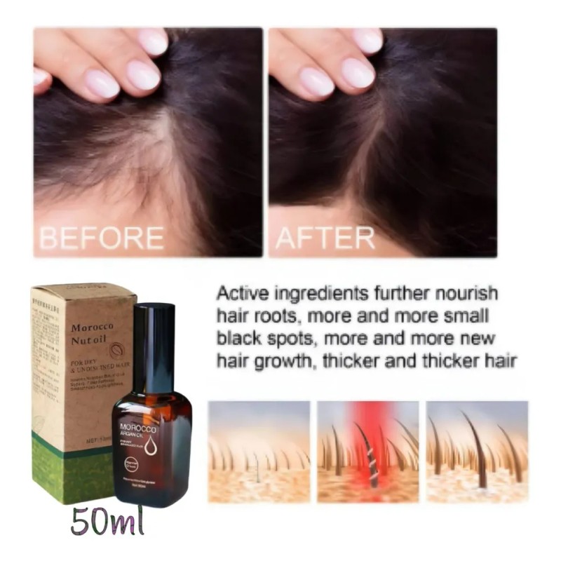 Tratamiento D Excelente Calidad Repara Nutrir Y Crecer 50ml