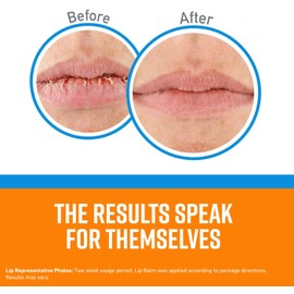 O'Keeffe's Cooling Relief Lip Repair Lip Balm for Dry, Cracked Lips, Stick