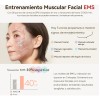 Maquina Radiofrecuencia Facial Portatil Skin Electroporador