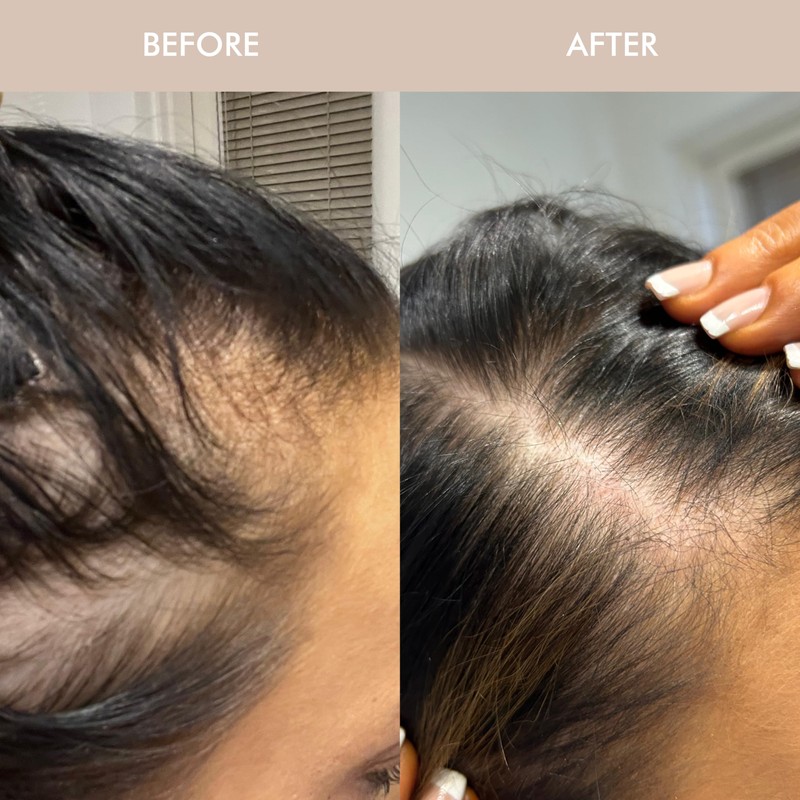 VANI-T Gloss Hair Growth Conditioner 370 ml