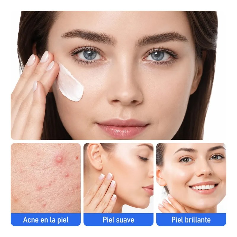2pcs 20% Ácido Azelaico Crema Con Vitamina C Y Niacinamida