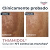Eucerin Serum Antimanchas Anti-Pigment 30 ml para Piel Grasa