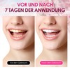 KAIOWPEIC 28 Stück Zahnaufhellungsstreifen, Zahnbleaching Set, Whitening Strips Zahnaufhellung, Schonend