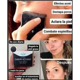 10 Jabón Azufre + Carbón Activado Para Acné & Puntos Negros
