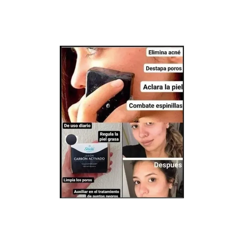10 Jabón Azufre + Carbón Activado Para Acné & Puntos