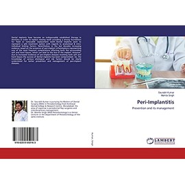 Peri-Implantitis: Prevention and its management