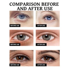 8ML Rollerball Castor Oil,Eye Cream,Castor Oil and Frankincense Eye Roller,Under Eye Cream,Castor Oil Hydrating Eye Cream,Eye Brightening Cream,Anti Aging Eye Cream,Firming Eye Cream,Eye Gel