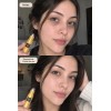 Serum Ojos Anti Ojeras Bolsas Arrugas Patas Gallo Pro! Todo