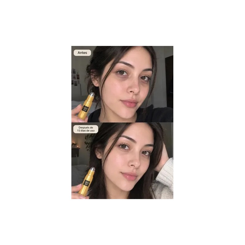 Serum Ojos Anti Ojeras Bolsas Arrugas Patas Gallo Pro! Todo