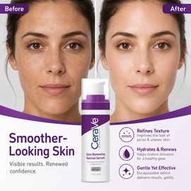 Retinol Face Serum with Hyaluronic Acid & Niacinamide – Daily Night Care for Smooth-Looking Skin