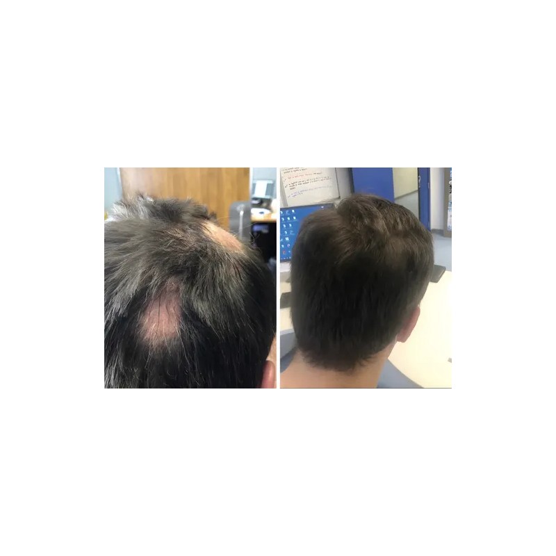 Shampoo Reviving Farmasi Caida Cabello