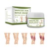 Varicose Veins Cream Natural Ointment for Varicose and Spider Veins
