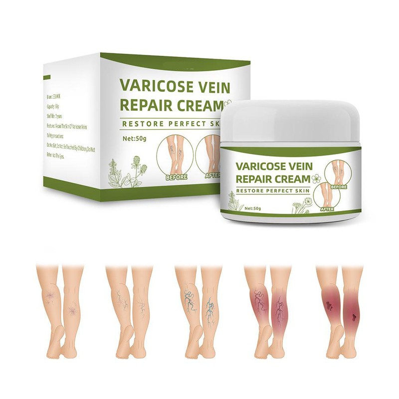 Varicose Veins Cream Natural Ointment for Varicose and Spider Veins