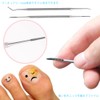Zonde Nail Scar Remover, Curling Nails, Stainless Steel, Rust Resistant,