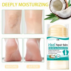 Foot Cream for Dry Feet,Heel Balm for Cracked Feet Treatment,Cracked Heel Repair Stick,Cracked Heel Cream,Foot Moisturiser,Light in Texture,Deeply Moisturizing for All Skin Types,Multi-Purpose Use