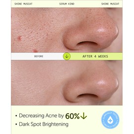 SERUMKIND Muscat Discoloration Correcting facial serum - 1fl oz - Blemishes & blackhead remover - Vegan Not Tested on Animals - Korean Skin Care - PHA Redness Relief and Exfoliating