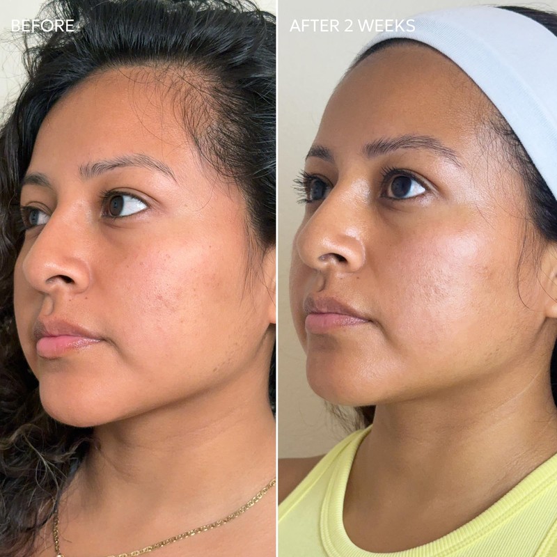 Dermisa Skin Fade Cream with Vitamin C | Helps Reduce