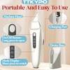 TTKYPO High Frequency Device for Face Skin Home Use