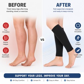 30–40 mmHg Calf Compression Sleeves for Men & Women – Footless Leg Support for Work, Travel & Sports