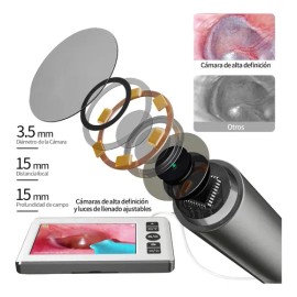 Limpiador De Oidos Cámara Otoscopio Digital 3.5mm 4.3'' Hd TKY