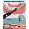 Stim-U-Dent Teeth Whitening Set, Whitening Set for Teeth Cleaning &