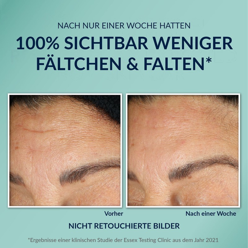 RoC - Multi Correxion Hydrate + Plump Serum - Maximum