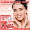 2pcs Missing Tooth Replacement Kit, Denture Repair Kit, Dental Impression