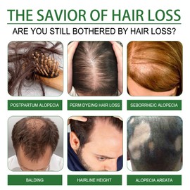 Rosemary Oil for Hair Growth, Organic Pure Rosemary Essential Oil, with Derma Roller for Hair, Hair Strengthening for Men Women, Scalp Massage & Nourish, Eyebrow Eyelash Growth Oils, 60ml, 2 Brushes