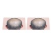 Man Bald Micropigmentattion Practice Skin Silicone Hairline Microblading Practice Pads